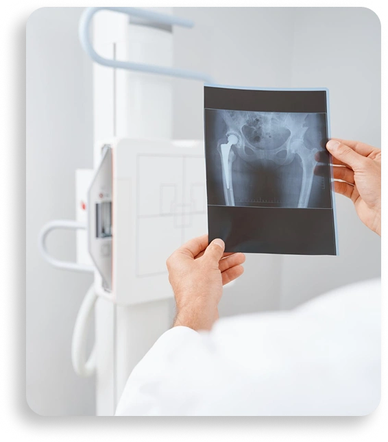 Radiografía